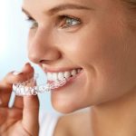 Invisalign and the Art of Modern Smile Design
