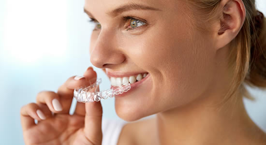 Invisalign and the Art of Modern Smile Design